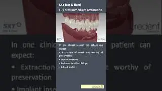 SKY fast & fixed Movie
