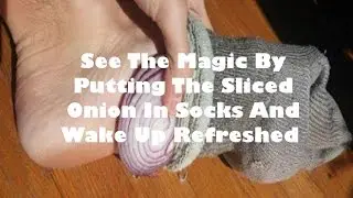 See The Magic By Putting The Sliced Onion In Socks And Wake Up Refreshed