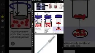Liquid Based Cytology | Genital System Pathology