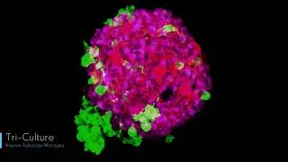 iPSC Derived Neuronal Spheroids