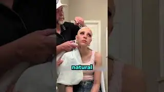 Из-за своего состояния ей пришлось подстричься 😢