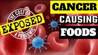 Cancer Causing Foods : Watch How You Consume These Foods.