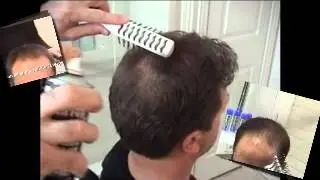 Zahusťovač vlasov HAIRFOR2 | Vlasy v spreji | Vypad&aacute;vanie vlasov