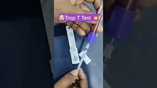 Trop T Test | how to perform trop t test #medical #heart #heartattack #ytshorts #viral