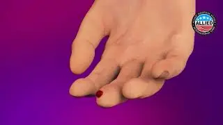 Determine HIV Early Detect Procedure