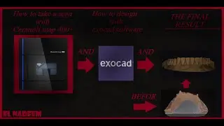 How to Scan with Amann Girrbach Ceramill Map 400 and Desing with exocad and make a Great case ?