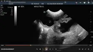 Goat scan
