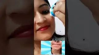Viral Salicylic Acid Ice cream Mask is Working 🤔 ? Instantly Remove Open pores Acne Blackheads .
