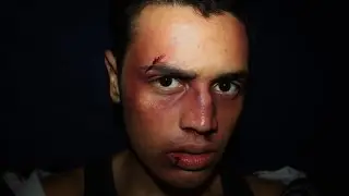 Bruise SFX makeup tutorial