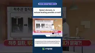 Spinal stenosis, is natural healing possible or not?#Shorts