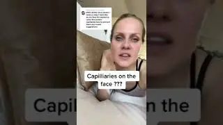 Capilliaries on the face???
