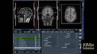 #Mri Brain Image planing 