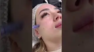 Nodira Yakubova cosmetology #shorts #shortsvideo #instagram