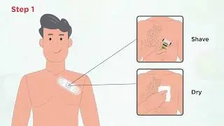 Zywie NanoPatch