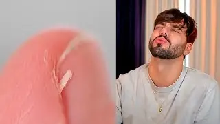 Toda sua dor em 10 minutos de vídeo