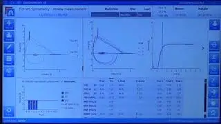 Spirometer SCHILLER Spiroscout - (Basic Usage Tutorial) #spirometer