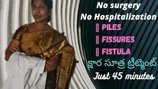 #Khara Sutra #క్షార సూత్ర ట్రీట్మెంట్ #పైల్స్ #ఫిషర్స్ #ఫిస్టులా #Cost (1500- 2000/week)| ⬆️# types