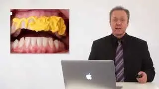 Honigum Pro Product Training: Impressions made your way.