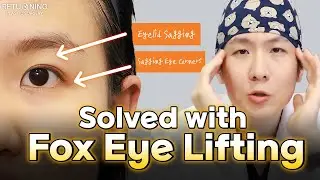 Sagging Eyelids & Droopy Corners? Solved with Fox Eye Lifting!