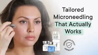 Does At-Home Microneedling Actually Work? @JadeyWadey180