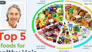 Top 5 foods to prevent Hair loss