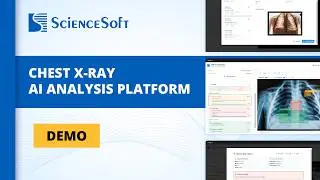 Платформа анализа рентгенограмм грудной клетки на основе ИИ | Демонстрационный тур