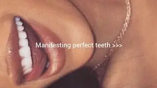 𑣲 PERFECT TEETH ~ straight white teeth, beautiful smile, teeth whitening treatment subliminal 🪩🦷