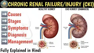 Chronic Renal Injury | Causes | Stages | Symptoms |Diagnosis & Management Of CRF/CRI/CKF/CKI/CRD/CKD
