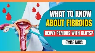 Understanding Fibroids | Gyna Talks