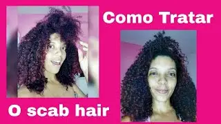 SCAB HAIR - Como Tratar o scab hair- Deu certo comigo