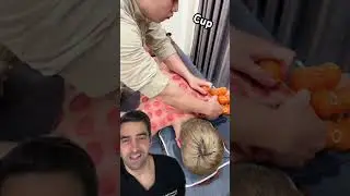 Cupping