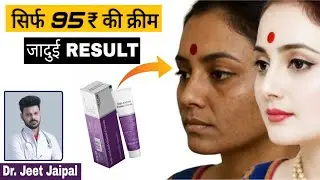 Zeelab Kojic Acid Vitamin C Cream Review 2026 🔥 Pigmentation & Dark Spots Result | Honest Review