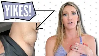 Pregnant? Here's what you should do if you find a LUMP in your armpit