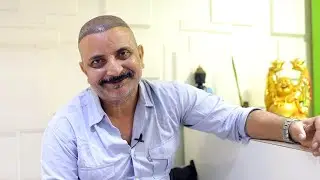 Mukesh Bhatt - Actor Hair Transplant | Celebrity Hair Transplant | Part - 1 |