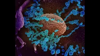 Understanding COVID-19 with Michael DiSpezio: What is a virus?
