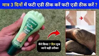 Latibule foot cream | best foot cream | Latibule foot cream review | foot cream