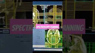 MR Spectroscopy Planning #viral #youtubeshorts #shorts