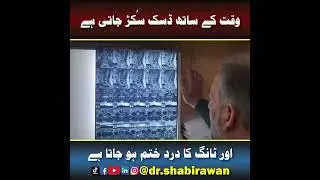 Herniated Disc Recovery Without Surgery | MRI Comparison 2017 vs 2025 | Back Pain Improvement