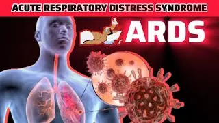 Acute Respiratory Distress Syndrome (ARDS) | Symptoms | Caused | Risk Factors | Treatment