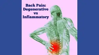Back pain- Inflammatory vs Degenerative