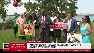 Henrietta Lacks' family reaches settlement over use of her immortal 'HeLa cells'