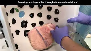 Essential Hernia Setup