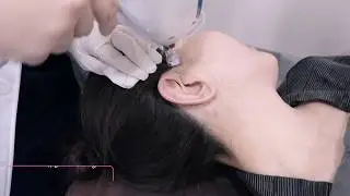 노원 에어젯, 즉각적인 쫀쫀탄력 리프팅이 된다?! 노원아이디뷰플