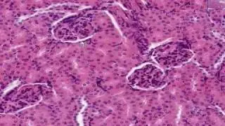 Histología de riñón