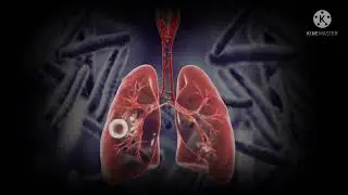 ಕ್ಷಯ ಮುಕ್ತ ಗ್ರಾಮ ಕಾರ್ಯಕ್ರಮ ಶಿರೋಳ #tuberculosis,#NTEP#TBAWARENESS,#ELIMINATETB