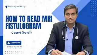 MRI Fistulogram &ndash; How to Read, Make Diagram & Plan Treatment | Case 6 (part 1)Dr. Sanjeet Sahu