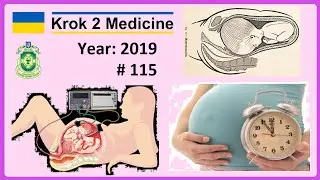 [ Krok 2 Medicine ] Year: 2019 - 115 (Ministry of Public Health of Ukraine)