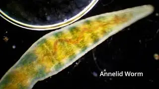 Annelid worm