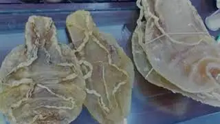 THE TOTABA   COCAINE OF THE SEA