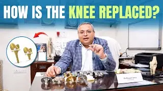 Knee Replacement Surgery Explained | Knee Implant Procedure & Instruments Used | Dr. Deepak Arora